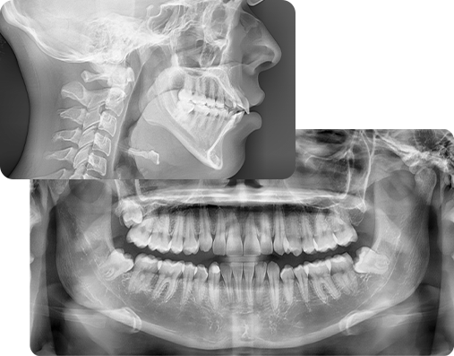 Rediseno 2 Radiografías dentales radiobeam inicio img 02