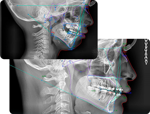 Rediseno 3 Radiografías dentales radiobeam inicio img 04