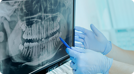 Radiografias Digitales 2D 1 Radiografías dentales radiobeam radiografias digitales img 01