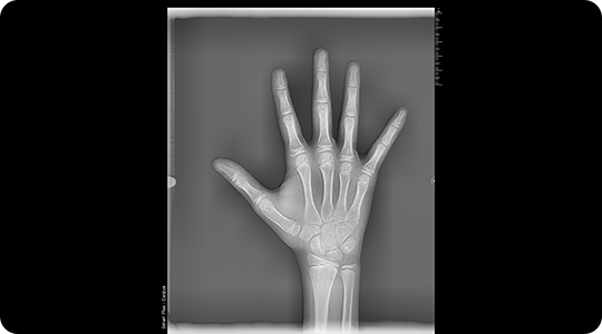 Radiografias Digitales 2D 4 Radiografías dentales radiobeam radiografias digitales img 04
